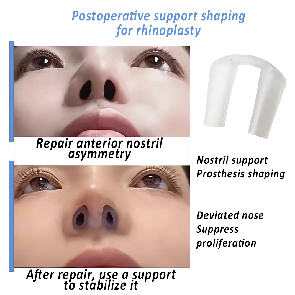 อุปกรณ์เสริมจมูกหลังผ่าตัด ซิล - Anti Snore Contour Pillow บทวิจารณ์และราคา